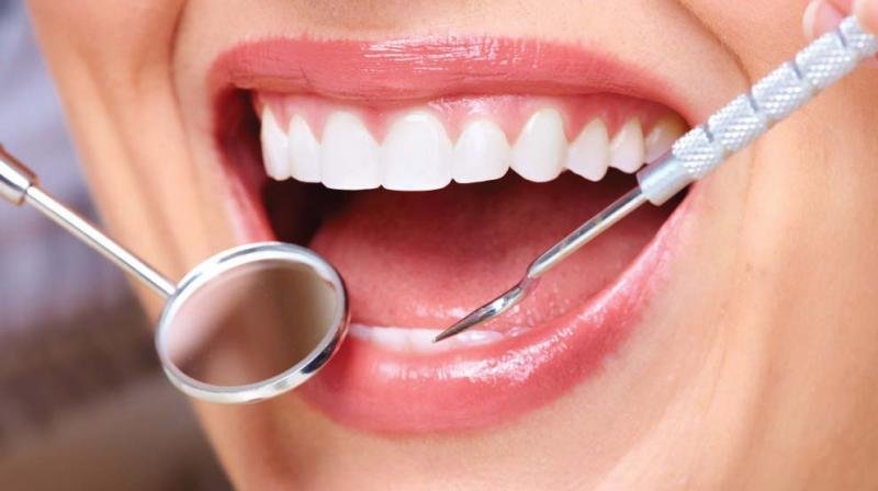 Common Myths About Dental Visits