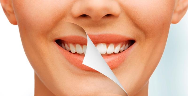 Secrets to Whiter Teeth
