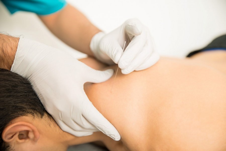 What is dry needling therapy