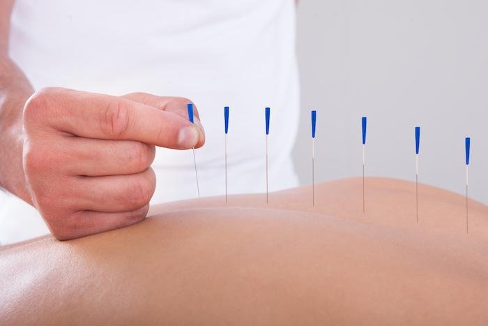 Precaution should be taken after dry needling therapy