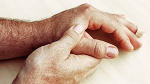 What is  Rheumatic diseases 